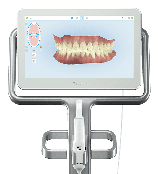 Escáner intraoral para registros digitales