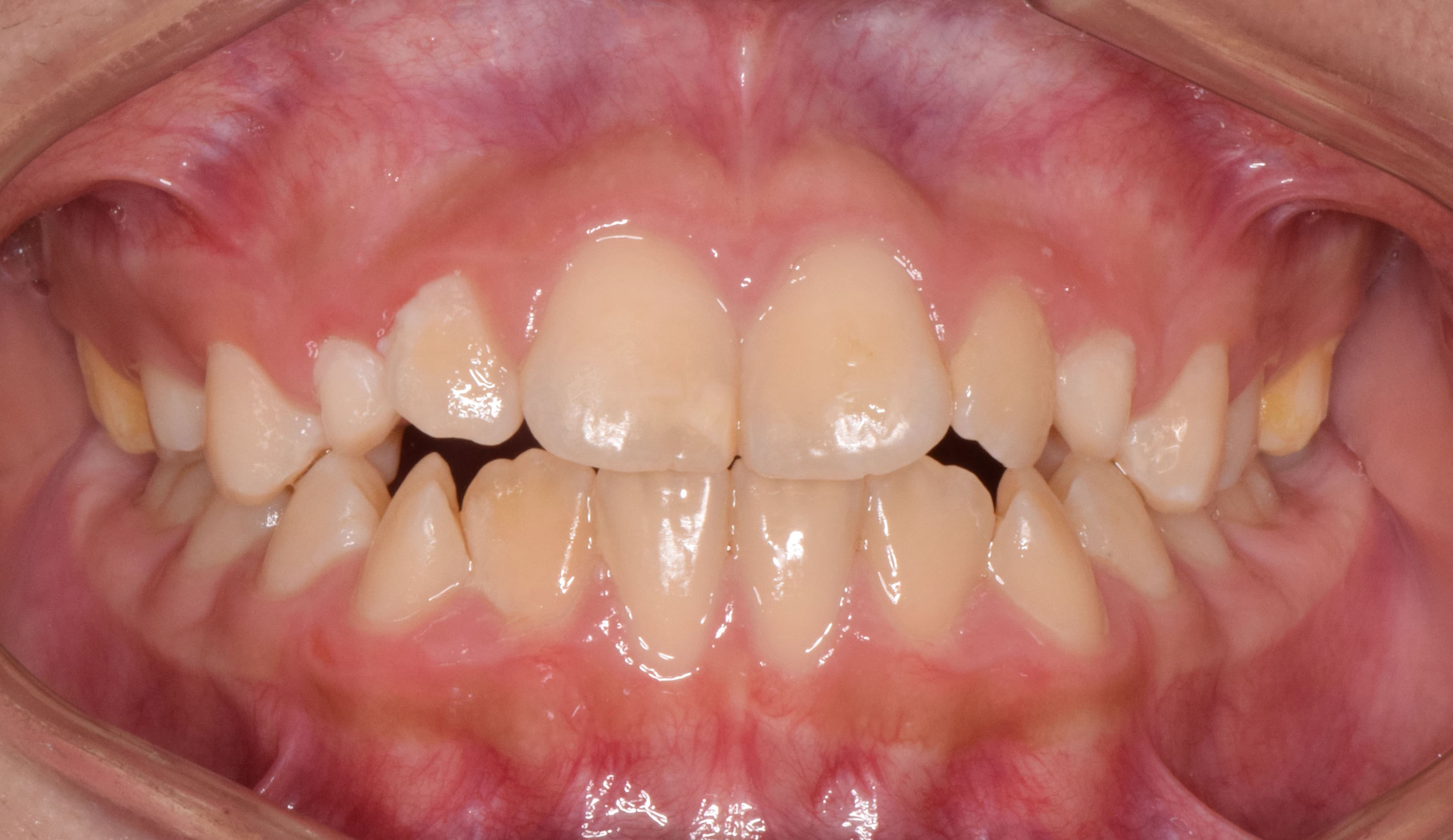 Fotografía clínica intraoral para documentación odontológica