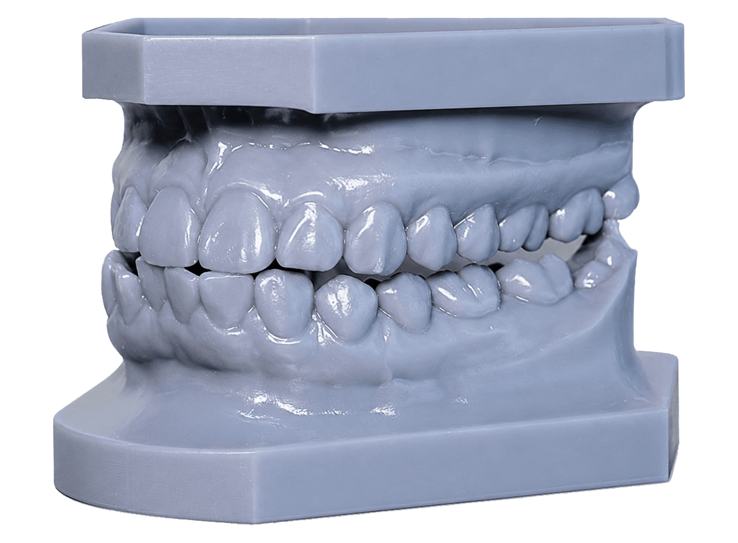 Modelos de estudio dentales en 3D